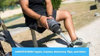 AMPUTATION: Types, Causes, Recovery Tips, and More