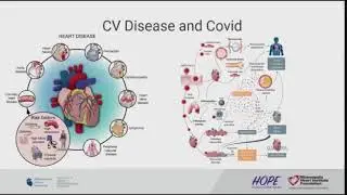 On the Pulse | Hypertension, Cardiac Risk Factors in the Time of COVID-19 | Retu Saxena, MD