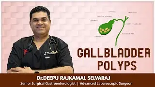 GALLBLADDER POLYPS
