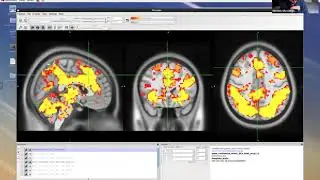 PALM + Randomise Comparison Video - Dr. Michael Hallquist