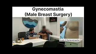 Gynecomastia Surgery In Indore | Cost Of Gynecomastia Surgery In Indore |  Zenith Clinic