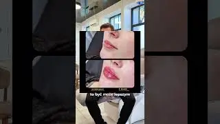 Lip lift czy wypełnianie ust kwasem hialuronowym? Co wybrać?