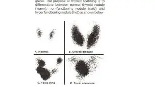 endocrine surgery section 5