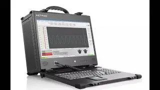NetPAC: 16 2.5