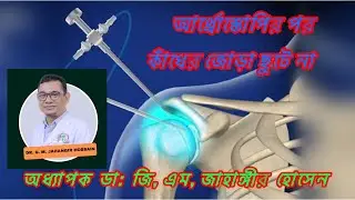 আর্থ্রোস্কোপিক সার্জারীর পর কাঁধের জোড়া ছুটে না