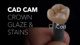 Icad CAD CAM CROWN Stains & Glaze / окрашивание цельнокерамической кад кам коронки