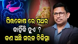 Gallbladder Stones or Cancer? Know the Early Signs & Treatment!