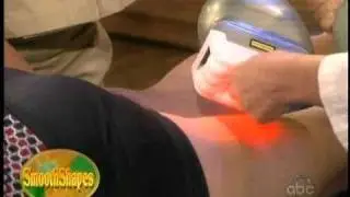 SmoothShapes&reg; on the View