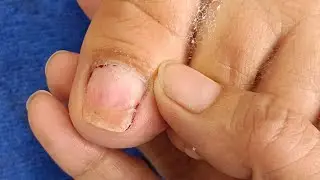 Pedicure February 18 #satisfying Neldz SOLO Parent  is live!
