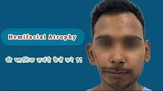 Hemifacial Atrophy or Hemifacial Microsomia: Plastic Surgery with Fat Grafting