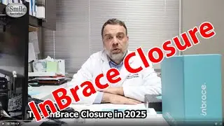 Inbrace Closure in 2025: What are the Options for Orthodontists and Patients