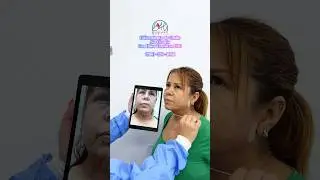 Hilos Tensores PDO en Miami | Estiramiento de Cuello Sin Cirug&iacute;a