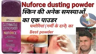 Nuforce dusting powder Ke fayde | lagane ka Sahi tarika,Use ,Dose Side Effects, Full Review in Hindi