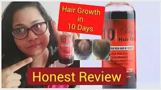 #10dayshairoil #Stophairfall  #SUBSCRIBE 10 Days Hair Oil - 10 दिनों में अपने नऎ बालों को उगाओ 😳