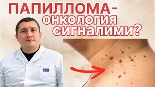 Папиллома: турлари, сабаблари ва даволаш усуллари