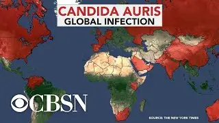 CDC warns about mysterious 
