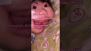 ANUGRAH TUMBUH GIGI🫢 #bayi #anugrah #anenchepaly
