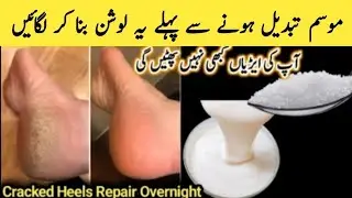 Hand and feet repair cream/ How To Save Money 🤑💸💰And Time With These Clever Hacks #diy