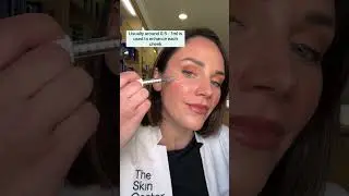 How much cheek filler is used in the cheeks? 💉