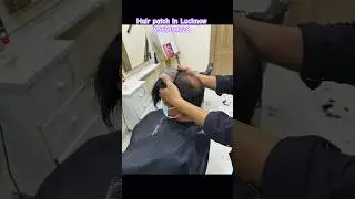 Clip Hair Patch for Men 😍 | Easy Wear & Remove | No Glue No Surgery | Natural Look ☎️9569199728