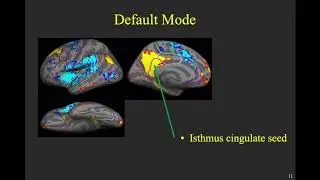 Resting State fMRI