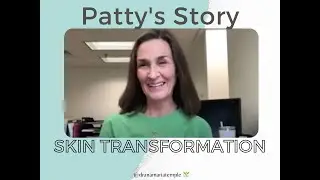 Skin Transformation Testimonial - Patty's Story | Dr. Ana-Maria Temple, Holistic Pediatrician