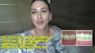Отбеливающий карандаш Super Booster Pen - мнение блогера Anna Sheina