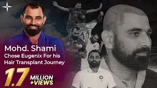 Cricketer Hair Transplants: Mohd. Shami's Hair Transformation Journey with Eugenix