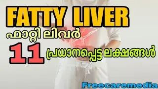 Fatty liver symptoms malayalam | #liverdisease #liver #liverdiseasesymptoms