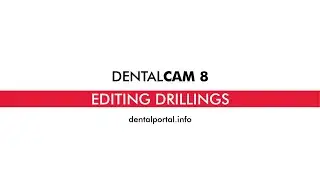 DentalCAM 8 – Editing drillings