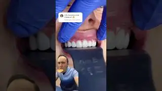 Este &ldquo;dise&ntilde;o de sonrisa&rdquo; destruy&oacute; sus dientes