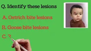 Norcet image based questions🎯🔥#nurseryrhymes#motivation#hospital#care#pediatrics#shortvideo