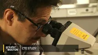 CTE Study