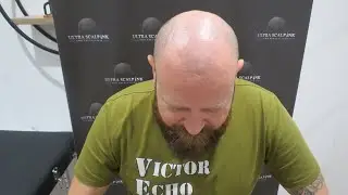 Can You Let Me Know More About Ultra Scalp Ink?