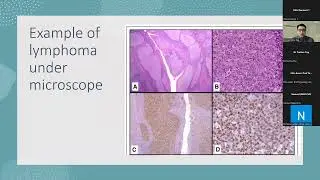 Introduction to White Blood Cell Cancers