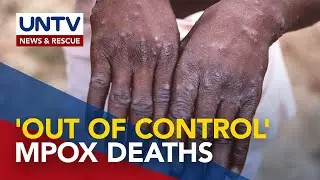 Bilang ng nasawi dahil sa mpox sa Africa, umabot na sa 1,100&mdash;CDC