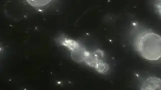 campo oscuro test hlbo darkfield