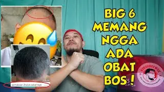 RAMBUT 2 BULAN LEBAT LAGI SEJAK PAKAI BIG 6 (MINOXIDIL,DLL) SAMPAI DIKIRA TESTIMONI PALSU!!