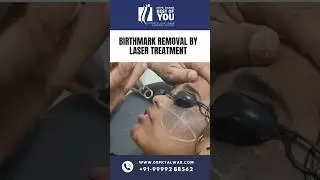 Birthmark Removal by Laser Treatment | Birthmark Removal Treatment in Delhi | Dr. PK Talwar