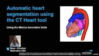 Automatic heart segmentation using the CT Heart tool