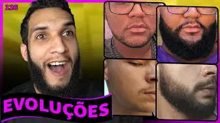 EVOLUÇÕES COM MINOXIDIL - BARBA ANTES E DEPOIS #126