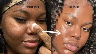 How I Cleared My Skin in 1 Year | Real, Raw Results
