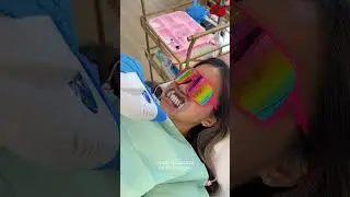 teeth whitening transformation 🦷 #teethwhitening #torontoteethwhitening