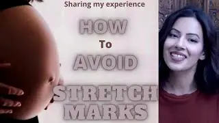 How to avoid stretch marks during pregnancy \ Pregnancy HACKS !! Harry gill !