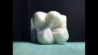Carving occlusal surface of UPPER 6 ( MAXILLARY FIRST MOLAR )