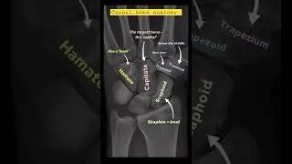 Carpal bone anatomy 😱#anatomy#bones #ctscan #xray #radiologytech