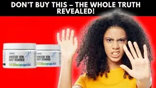 Veincare Varicose Review 🦵: VARICOSE VEINS Solution? (2026)