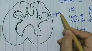 Medulla oblongata (part 2) internal features.Level of decussation of pyramids.