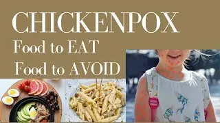 Chickenpox Diet | Food To Eat in Chickenpox | Food To Avoid In Chickenpox