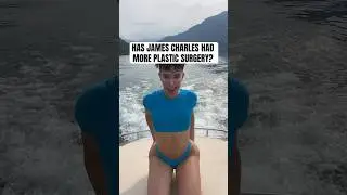 James Charles Fans Wonder If He Got More Plastic Surgery #shorts #jamescharles #coachella2025